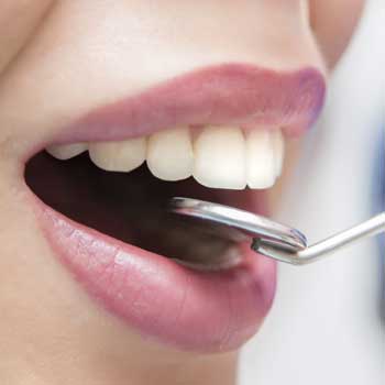 Oral-Consultation-Dental-Services-in-Coral-Gables-New-350px